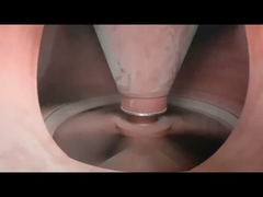 1 - vertikale VRM Zement-Mühle 45t/H für das Rohstoff-Reiben